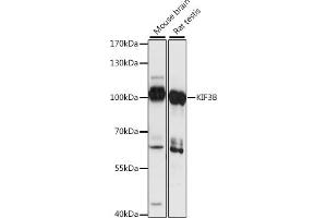 Western blot analysis of extracts of various cell lines, using KIF3B antibody (ABIN7268133) at 1:1000 dilution. (KIF3B antibody  (AA 663-747))