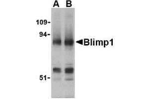 Western blot analysis of Blimp-1 in mouse lung tissue lysate with AP30155PU-N Blimp-1 antibody at (A) 0. (PRDM1 antibody  (N-Term))