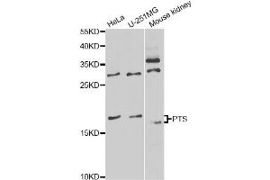 Western blot analysis of extracts of various cell lines, using PTS antibody (ABIN6291724) at 1:1000 dilution. (PTS antibody)