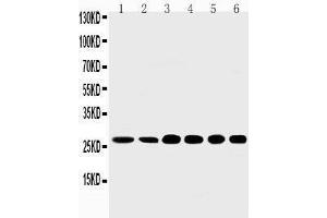Anti-Sonic Hedgehog antibody,  Western blotting Lane 1: Rat Liver Tissue Lysate Lane 2: Rat Intestine Tissue Lysate Lane 3: HELA Cell Lysate Lane 4: A549 Cell Lysate Lane 5: SMMC Cell Lysate Lane 6: MM231 Cell Lysate (Sonic Hedgehog antibody  (N-Term))