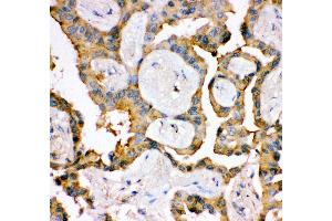 Immunohistochemistry (IHC) image for anti-Insulin Receptor Substrate 1 (IRS1) (AA 1041-1242) antibody (ABIN3043251)