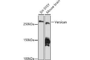 Western blot analysis of extracts of various cell lines, using Versican antibody (ABIN7271309) at 1:1000 dilution. (Versican antibody)
