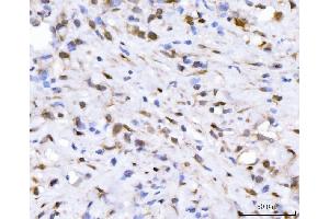 IHC analysis of FGF2 using anti-FGF2 antibody (ABIN7603215). (FGF2 antibody  (N-Term))