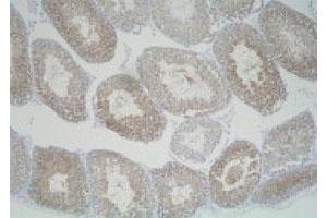 Immunohistochemistry (Formalin/PFA-fixed paraffin-embedded sections) of mouse testis with Slc25a19 polyclonal antibody . (SLC25A19 antibody)