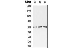 Western blot analysis of Monoamine Oxidase A expression in HEK293T (A), Raw264. (Monoamine Oxidase A antibody  (Center))