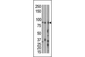 The anti-MARK1 C-term Pab is used in Western blot to detect MARK1 in, from left to right, Hela, T47D, and mouse brain cell line/ tissue lysate. (MARK1 antibody  (C-Term))