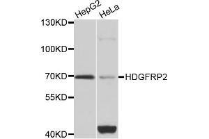 Western blot analysis of extracts of various cell lines, using HDGFRP2 antibody (ABIN5975300) at 1/1000 dilution. (HDGFRP2 antibody)
