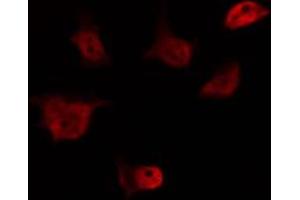 ABIN6274561 staining HeLa by IF/ICC. (EID1 antibody  (Internal Region))