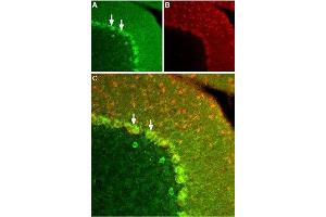 Expression of KISS1R in rat cerebellum - Immunohistochemical staining of frozen rat cerebellum section using Anti-KISS1 Receptor (GPR54) (extracellular) Antibody (ABIN7043294, ABIN7044548 and ABIN7044549), (1:100). (KISS1R antibody  (3rd Extracellular Loop))