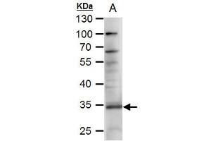 WB Image RANKL antibody [C2C3], C-term detects RANKL protein by western blot analysis.
