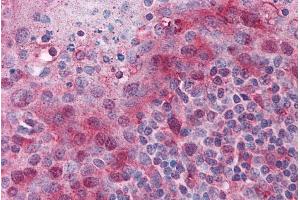 Immunohistochemistry (IHC) image for anti-PYD and CARD Domain Containing (PYCARD) (C-Term) antibody (ABIN184674)