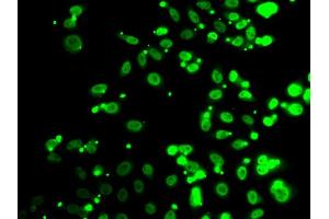 Immunofluorescence analysis of A549 cell using FIP1L1 antibody. (FIP1L1 antibody)