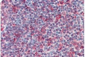 Anti-CD70 antibody  ABIN960750 IHC staining of human tonsil. (CD70 antibody  (Internal Region))
