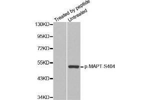 Western Blotting (WB) image for anti-Microtubule-Associated Protein tau (MAPT) (pSer404) antibody (ABIN3019704) (MAPT antibody  (pSer404))