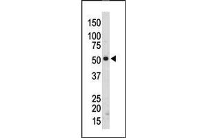 The anti-SRMS Pab (ABIN392109 and ABIN2841861) is used in Western blot to detect SRMS in mouse kidney tissue lysate. (SRMS antibody  (C-Term))