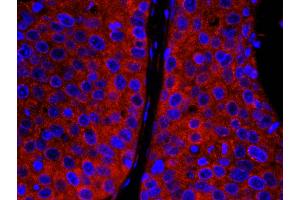 Immunofluorescence (IF) image for anti-Carbamoyl-Phosphate Synthetase 2, Aspartate Transcarbamylase, and Dihydroorotase (CAD) (AA 1650-1700) antibody (ABIN7448935)