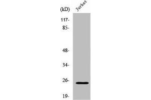 Western Blot analysis of Jurkat cells using Rit1 Polyclonal Antibody (RIT1 antibody  (C-Term))