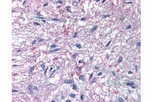 Anti-GPR50 antibody IHC of human pituitary. (GPR50 antibody  (C-Term))