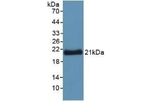 Detection of Recombinant YWHAz, Human using Polyclonal Antibody to Tyrosine 3/Tryptophan 5 Monooxygenase Activation Protein Zeta (YWHAz) (14-3-3 zeta antibody  (AA 1-245))