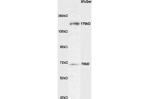 Rat brain lysate probed with Anti Robo4 Polyclonal Antibody, Unconjugated  at 1:3000 for 90 min at 37˚C. (ROBO4 antibody  (AA 261-360))