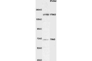 ROBO4 anticorps  (AA 261-360)