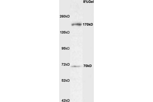 ROBO4 Antikörper  (AA 261-360)