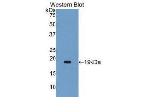 Western Blotting (WB) image for anti-Alpha2 Antiplasmin (SERPINF2) (AA 340-491) antibody (ABIN1172474)