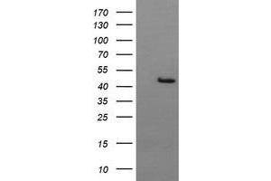 Image no. 2 for anti-butyrobetaine (Gamma), 2-Oxoglutarate Dioxygenase (Gamma-butyrobetaine Hydroxylase) 1 (BBOX1) antibody (ABIN1496820) (BBOX1 antibody)