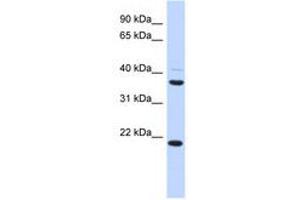 Image no. 1 for anti-Transmembrane Protein 74 (TMEM74) (AA 215-264) antibody (ABIN6741230) (TMEM74 antibody  (AA 215-264))