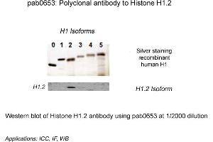 Image no. 1 for anti-Histone Cluster 1, H1c (HIST1H1C) (N-Term) antibody (ABIN410164)