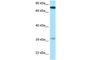 WB Suggested Anti-Gucy1b3 Antibody Titration: 1. (GUCY1B3 antibody  (N-Term))