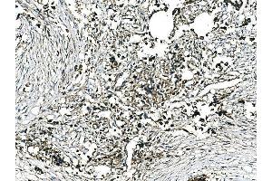 IHC analysis of GRHL2 using anti-GRHL2 antibody (ABIN7599505). (GRHL2 antibody  (AA 1-625))