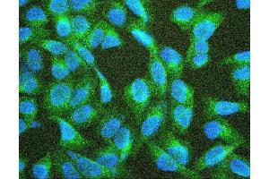 IF analysis of TEK using anti-TEK antibody (ABIN7600762). (TEK antibody  (AA 23-616))