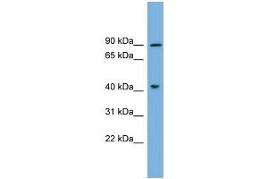 WB Suggested Anti-DYRK1A Antibody Titration: 0. (DYRK1A antibody  (N-Term))