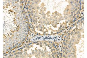 ABIN6263917 and ABIN6272379 at 1/100 staining Rat testis tissue by IHC-P. (OTUB2 antibody  (Internal Region))