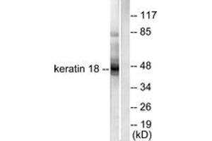 Western blot analysis of extracts from HeLa cells, using Keratin 18 Antibody. (Cytokeratin 18 antibody  (AA 381-430))