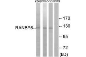 Western blot analysis of extracts from COS7/K562/COLO cells, using RANBP6 Antibody.