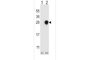 Western blot analysis of RGS4 using rabbit polyclonal RGS4 Antibody using 293 cell lysates (2 ug/lane) either nontransfected (Lane 1) or transiently transfected (Lane 2) with the RGS4 gene. (RGS4 antibody  (AA 147-174))