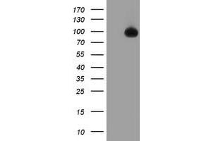 HEK293T cells were transfected with the pCMV6-ENTRY control (Left lane) or pCMV6-ENTRY TFR2 (Right lane) cDNA for 48 hrs and lysed.