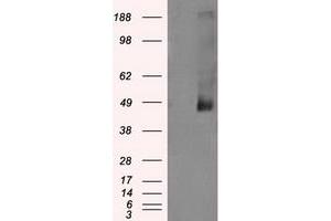 Western Blotting (WB) image for anti-Lysyl Oxidase (LOX) (AA 22-168) antibody (ABIN1491219)