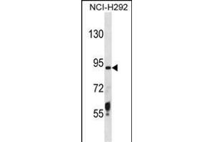 TRSS6 Antibody (N-term) (ABIN1881891 and ABIN2838364) western blot analysis in NCI- cell line lysates (35 μg/lane). (TMPRSS6 antibody  (N-Term))