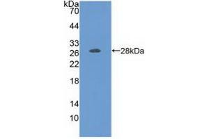 Detection of Recombinant FOLR1, Human using Polyclonal Antibody to Folate Receptor 1, Adult (FOLR1) (FOLR1 antibody  (AA 25-234))