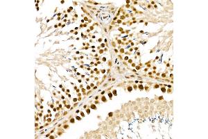 Immunohistochemistry of paraffin-embedded rat testis using  Rabbit pAb (ABIN6133085, ABIN6136806, ABIN6136807 and ABIN6215376) at dilution of 1:150 (40x lens). (ALKBH5 antibody  (AA 245-394))