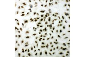 Anti-XRCC1 antibody, ICC ICC: A549 Cell (XRCC1 antibody  (N-Term))