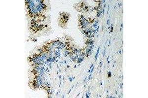 Immunohistochemical analysis of LLGL2 staining in human prostate formalin fixed paraffin embedded tissue section. (LLGL2 antibody)