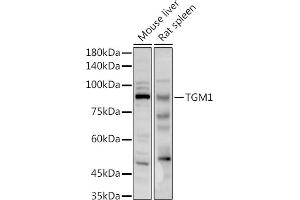 Western blot analysis of extracts of various cell lines, using TGM1 antibody (ABIN6129517, ABIN6149090, ABIN6149092 and ABIN6217322) at 1:1000 dilution. (TGM1 antibody  (AA 100-280))