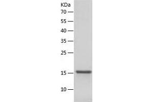 Western Blotting (WB) image for Methylmalonyl CoA Epimerase (MCEE) (AA 37-176) protein (His tag) (ABIN7288433) (MCEE Protein (AA 37-176) (His tag))