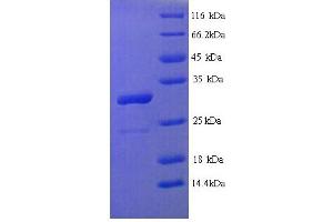 SDS-PAGE (SDS) image for Homeobox B4 (HOXB4) (AA 1-251), (full length) protein (His tag) (ABIN5713510)
