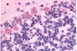 Anti-GPR89A antibody  ABIN1048895 IHC staining of rat brain, Purkinje neurons. (GPR89A antibody  (Cytoplasmic Domain))