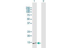 Western Blot analysis of PRY2 expression in transfected 293T cell line by PRY2 MaxPab polyclonal antibody.